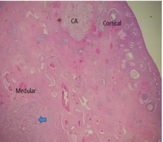 Figura  4.  Região  medular  com  hiperplasia  adenomatosa  de  rete ovarii (seta) em ovário de cadela submetida à  ovariectomia.; CA- corpus albicans - objetiva 40x