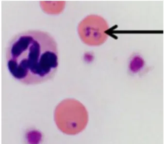 Figura  2.  Hemácias  com  piroplasmas  característicos  de  Cytauxzoon sp. em forma de anel (seta preta) em  esfregaço  sanguíneo  de  paciente  felino