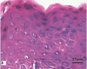 Figure 3. Abdominal skin dog with LV. Epidermal  parakeratosis presenting with presence of  nuclei in the stratum corneum (or Cc Ec)