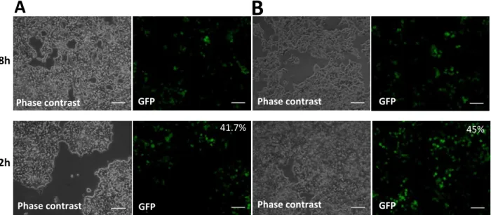 Figure  10  |  HEK  293T  cell  line  transfection  assay  of  for  best  plasmid  concentration  of  the  “Tol2-mediated  gene  transfer”  and  “tetracycline-dependent  conditional  expression”  combined  system  of  vectors
