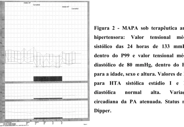 Figura  2  -  MAPA  sob  terapêutica  anti- anti-hipertensora:  Valor  tensional  médio  sistólico  das  24  horas  de  133  mmHg,  dentro  do  P99  e  valor  tensional  médio  diastólico  de  80  mmHg,  dentro  do  P95  para a idade, sexo e altura