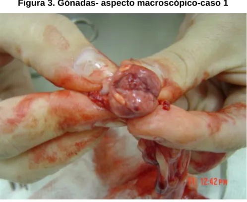 Figura 4. Aspecto microscópico-caso 1 