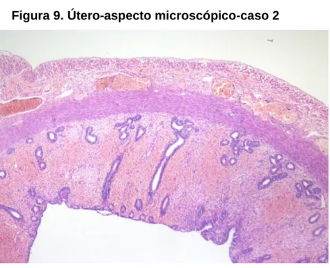 Figura 9. Útero-aspecto microscópico-caso 2 