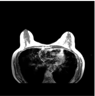 Figure 2.5: MR image example from an axial cut.
