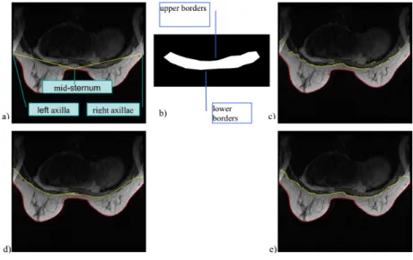 Figure 2.9: Lu et al. [2006] algorithm iteration demonstration from a) to e)