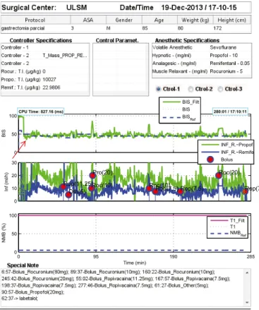 Fig. 1. Patient 1. The desired BIS level was initially set to be 50 and then was set to be 45 until the end of the surgery