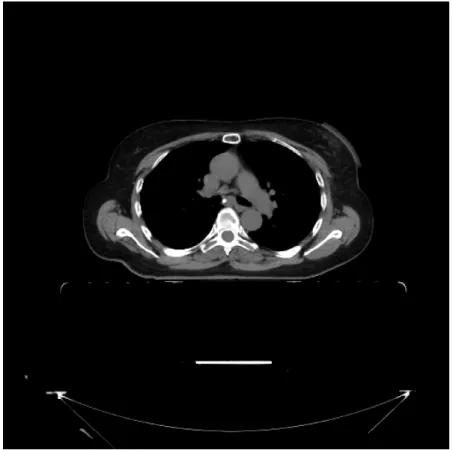 Figure 2.8: Ct slice example. Axial view. Imaging data provided by Fundação Champalimaud.