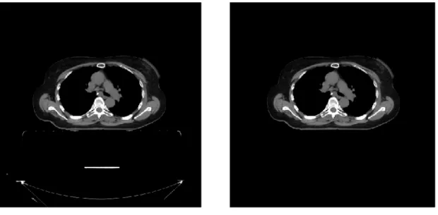 Figure 3.3: Effect of clearing artifacts from the image in axial view.