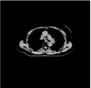 Figure 3.4: Thresholding the image with multi level Otsu values result in obtaining different views of the body.