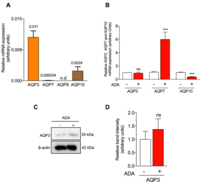 Figure 3. Effect of SAH accumulation on aquaglyceroporins expression in HUVEC. (A)—AQP3,  AQP7, AQP9 and AQP10 mRNA expression levels