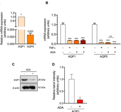 Figure 4. Effect of SAH and TNF-α in AQP1 and AQP5 expression. (A)—AQP1 and AQP5 mRNA  expression levels in HUVEC