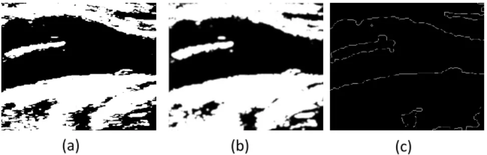 Figure 3: Automatic identification of the lumen region of the CCA in one B-mode ultrasound image of the  carotid  artery:  (a)  Cropped  image  after  the  application  of  a  Gaussian  low-pass  filter;  (b)  All  possible  pixel  candidates for the lumen