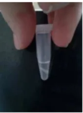 Figure 5 - Two phases of the samples treated with ice-cold chloroform/ethanol. The top phase is the aqueous phase,  white in the middle is the interphase and the bottom phase is the organic phase