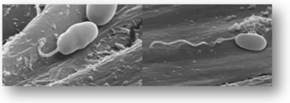 Figura  4.   Fotografias  de  microscopia  electrónica  de  varrimento  do  esporo  de  microsporida com o filamento polar exteriorizado injectando o esporoplasma na célula  Adaptado de [Franzen 2008].