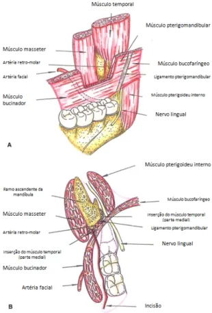 Figura 2 - Representação esquemática da anatomia da região do 3MI (adaptado de Escoda [51] )