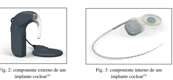 Fig. 2: componente externo de um  implante coclear (5)