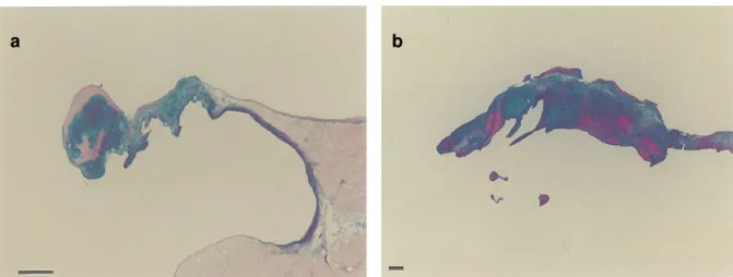 Figura n.º2 – Fotografia de corte histológico de um folheto septal da mitral de canídeo (a) e de  um humano (b) afectados por LDCVM e PVM, respectivamente 