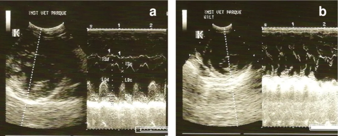 Figura n.º4 – Imagens ecocardiográficas em modo 2D e modo TM -  corte transventricular (n.º2  de Feigenbaum) e corte transmitral (n.º3 de Feigenbaum)
