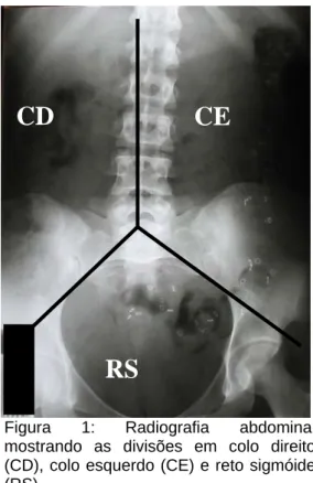 Figura 1: Radiografia abdominal  mostrando as divisões em colo direito  (CD), colo esquerdo (CE) e reto sigmóide  (RS)