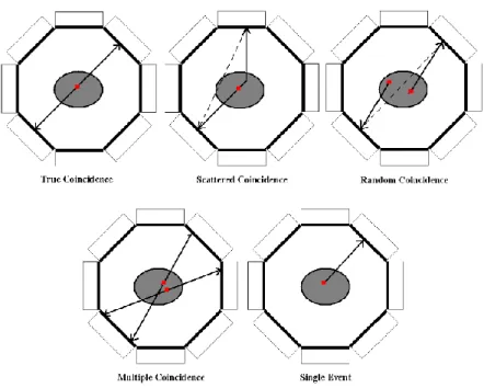 Figure 2. 5: PET events: True, scatter, random, multiple and single events (Mendes 2012)
