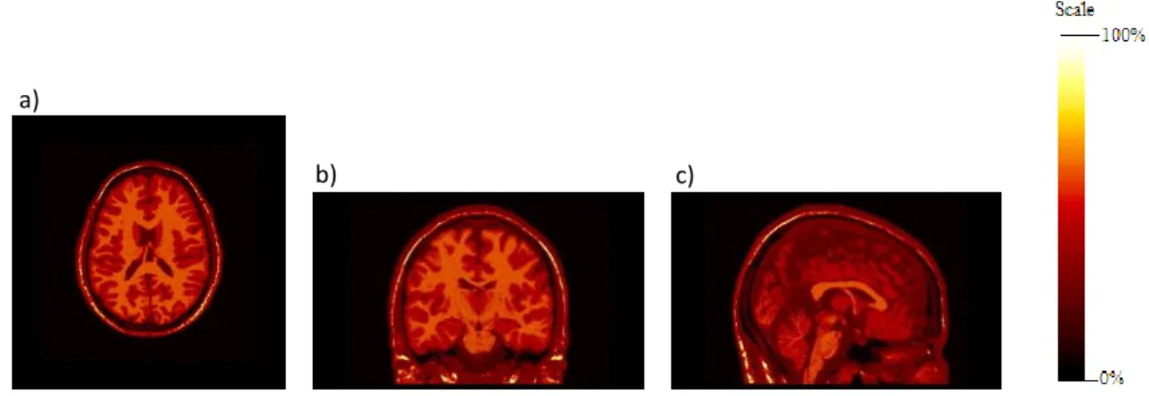 Figure 4. 9: Simulated brain phantom: FLASH sequence image. a) transversal, b) coronal and c) sagittal views