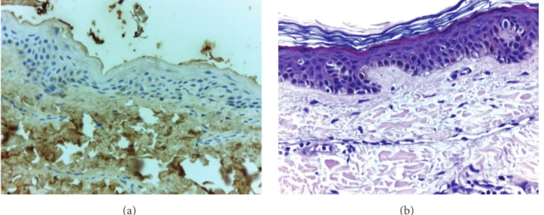 Figure 3: Image (a) represents a negative control for epidermal AGE immunostaining, from a young healthy individual