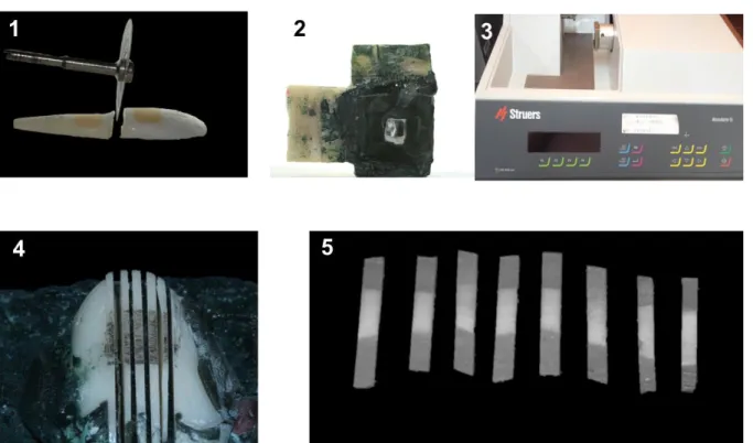 Figura 6: Imagem ilustrativa da confecção dos palitos para microtração. Separação porção coronária  da  porção  radicular  (1),  Fixação  da  cavidade  no  dispositivo  de  corte  (2),  Maquina  de  corte  (3),  Sequencia de cortes perpendicular a restaura