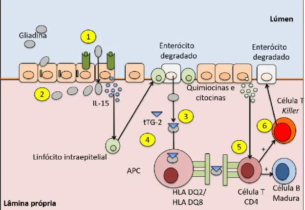 Figura 2 - Resposta inflamatória e autoimune na DC 