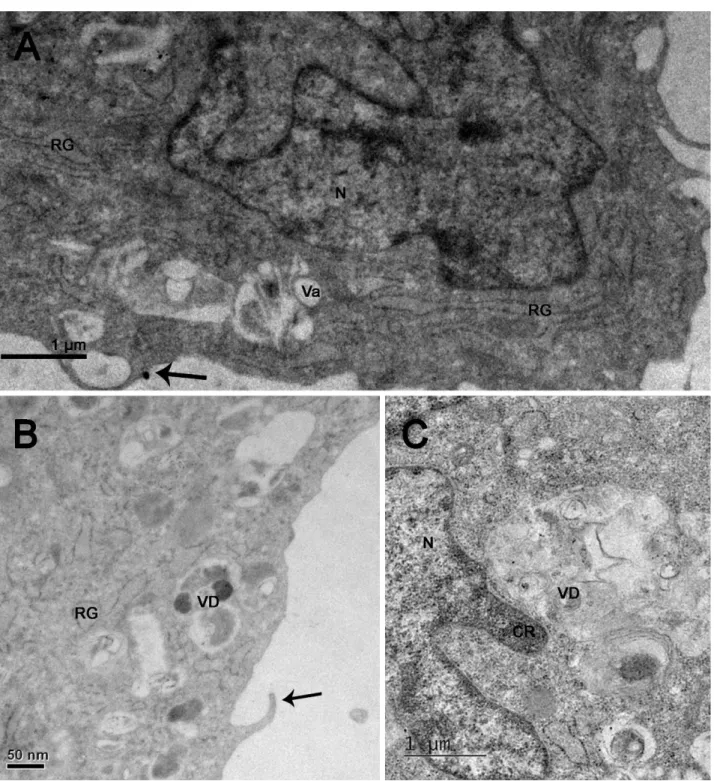Figura 10. Microscopia eletrônica de transmissão de fibroblastos de Panthera onca (onça preta)