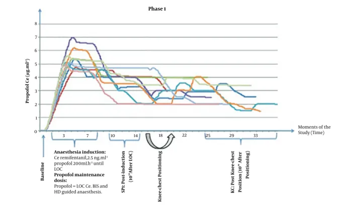Figure 2. Relationship between propofol effect-site concentration (Ce) ( µ g.mL -1 ) and moments of the study (time) in phase I (baseline, SP1, and KC)
