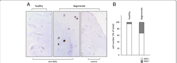 Fig. 5 EGR1 expression is increased in degenerate NP cells. a Immunodetection of EGR1-positive cells in healthy control NP tissue (L1/L2 IVD of a 63 years old donor; left panel) and in degenerate NP tissue (L4/L5 IVD of the same donor middle panel); right 