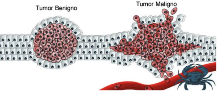 Figura 2 – Características dos tumores benignos e malignos 