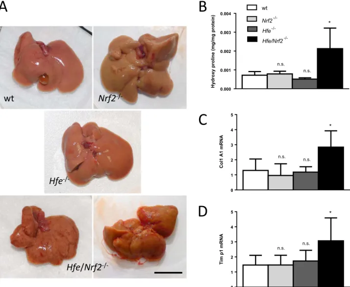 Fig. 1. Liver macroscopy and ﬁbrosis markers in old mice. (A) Macroscopic appearance of livers of representative old mice demonstrating the irregular surface and the contracted, distorted and nodular appearance of the Hfe/Nrf2 -/- livers (Bar=1 cm)