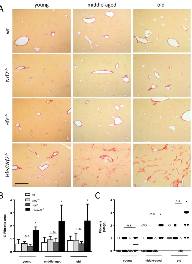 Fig. 2. Histological evaluation of liver ﬁbrosis. (A) Sirius red staining for collagen in paraﬃn-embedded liver sections