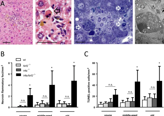 Fig. 5. Histological evaluation of necroinﬂammatory lesions. (A) Representative necroinﬂammatory foci in Hfe/Nrf2 -/- mouse livers containing apoptotic bodies and iron pigment in histiocytes