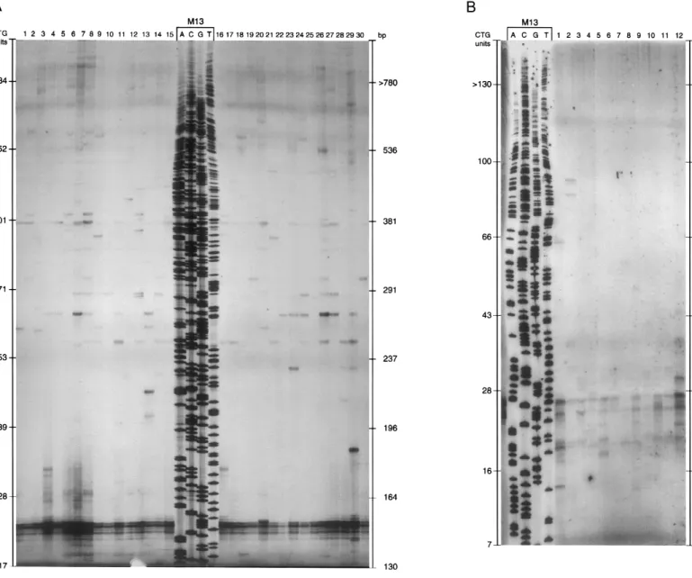 Figure 4 Low-copy PCR of sperm cells. DNA was amplified with primers SCA8-F4 and SCA8-R4 and analyzed on 6% polyacrylamide gels