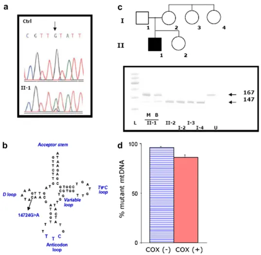 Fig. 2. Mutation analysis of the mitochondrial tRNA Glu gene. (a) Electropherogram of the polymerase chain reaction–ampliﬁed blood DNA of a control (Ctrl) and of patient II-1; an arrow indicates the mutation