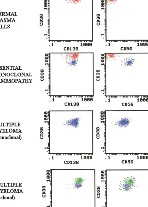 FIG. 2. Illustrative dot plots showing normal plasma cells (red dots) and abnormal plasma cells (blue dots) in marrow from normal individuals, myeloma and MG patients.