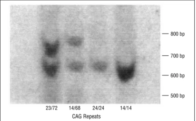 Figure 6. Southern blot analysis of the (CAG) n -containing segment of the gene for Machado-Joseph disease