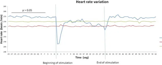 Figure 9 - In Ctrl without stimulation and in stressed animals, stimulation of the insula failed to induce  bradycardia