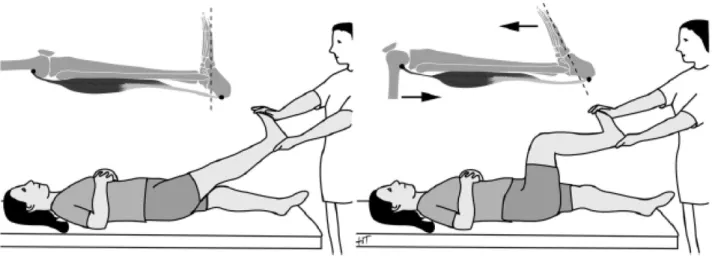 Figura 1 – Avaliação da dorsiflexão passiva do pé