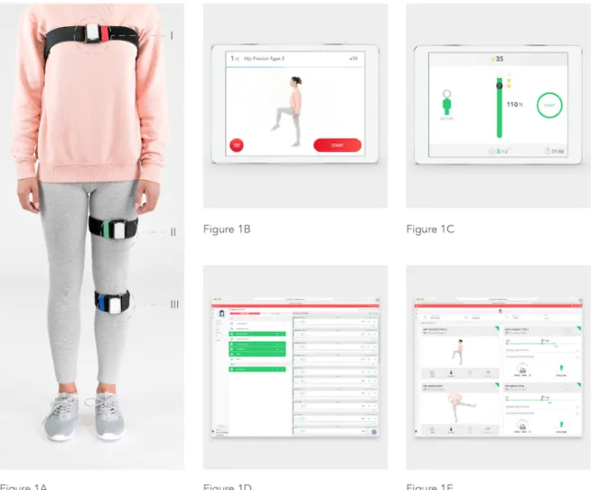 Figure 1.  System components. (A) Motion tracker setup. (I) Red tracker: over the sternal manubrium