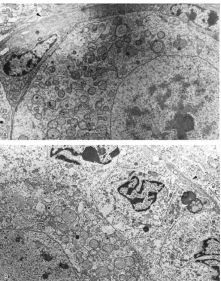 Fig. 4. Electron micrographs of follicles cryopreserved in 1.5 M (A) and 3 M (B) DMSO
