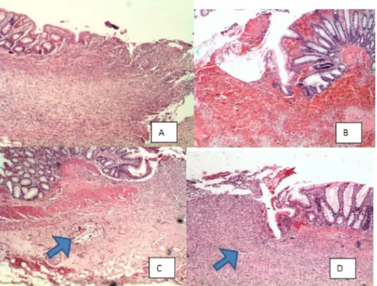 FIGURE 7 -  Correlation  between  DB/TB  ratio  and  bursting  pressures in the four study groups (pooled analysis).