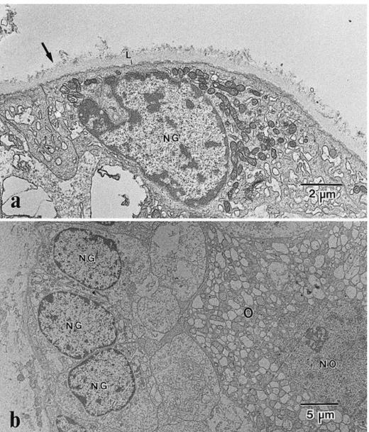 Fig.  4.  Electron  micrographs  of  preantral  follicles  after  mechanical  isolation  showing  (a)  the  basement  membrane  (arrow);  L:  Basal  lamina,  and  (b)  a  normal  follicle