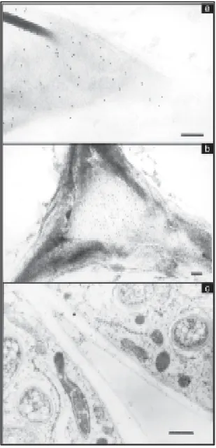 Figure 6. Gold-labeling of the intercellular space using MAC 236 in Carioca watered (a); at eight days of water stress (b) and gold-labeling of the intercellular space in infected cells, using MAC 265 in EMGOPA-201 watered (c)