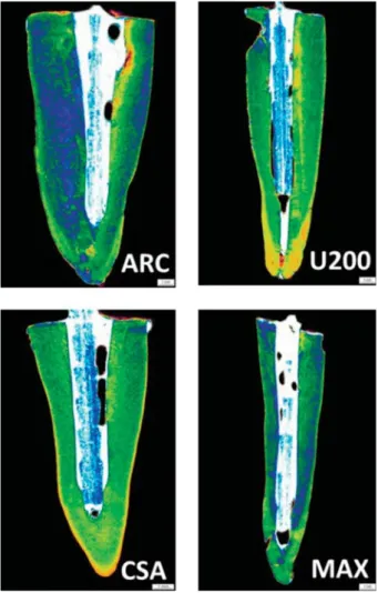 Figure 3- μCT scanning of the roots cemented using the  UHVLQFHPHQWV$5&amp;$5&amp;5HO\;88&amp;OHDU¿O SA Bond (CSA), and Maxcem Elite (MAX) as a function of  the manufacturer’s instructions