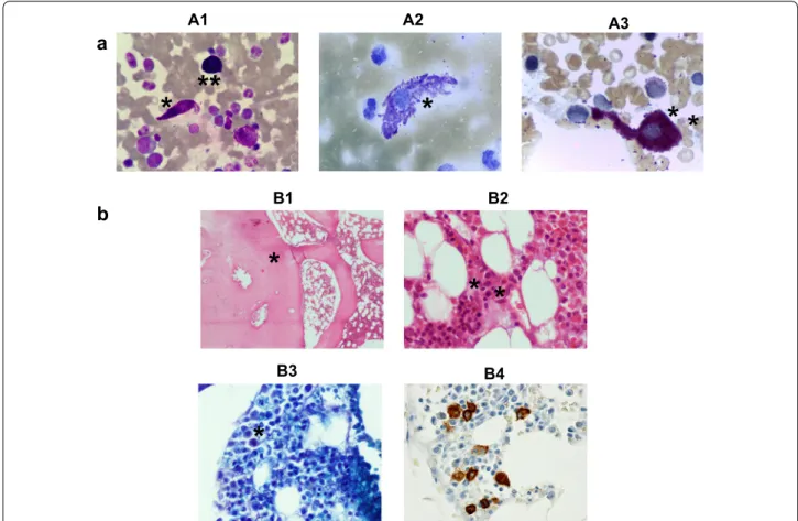 Fig. 1  Bone marrow cytological and histopathological features at diagnosis. a Leishman’s (A1), toluidine blue (A2) and chloroacetate esterase (A3)  staining of bone marrow (BM) smears from the patient at diagnosis, revealing atypical mast cells (MCs) with