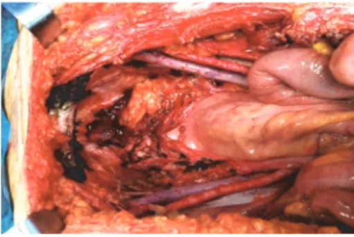 Figure 1: Intraoperative view.