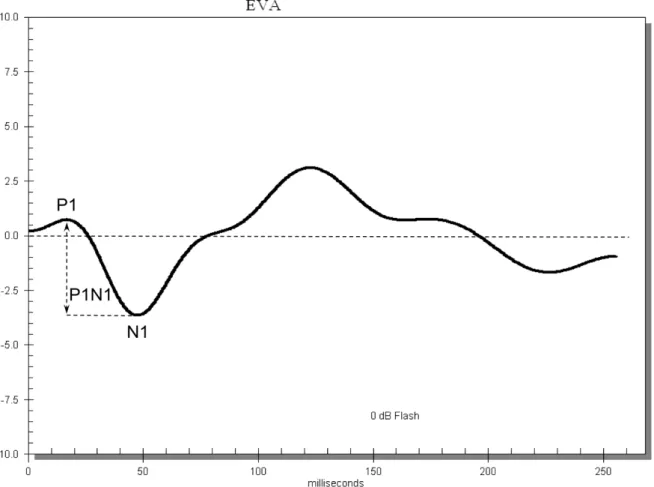 Figura 3. Exemplo de um traçado normal do EVA. A seta vertical tracejada indica a amplitude máxima das ondas P1 e N1 e a  amplitude do componente P1N1, expressas em microvolts (µV)